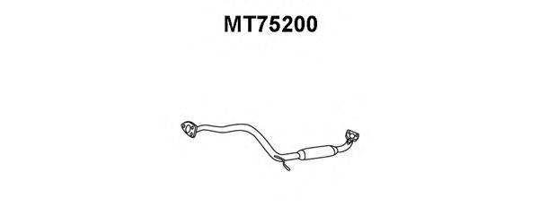 VENEPORTE MT75200